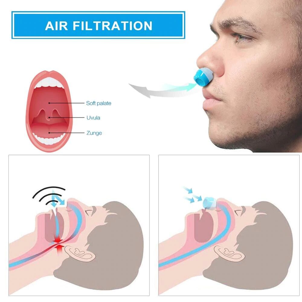 DreamFlow - Advanced Snoring Device - Compact, Tubeless Micro CPAP for Quiet, Unrestricted Sleep